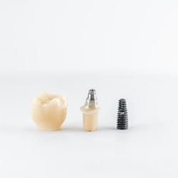 Dental implants & crowns - common misconceptions - Kenosha Dentist