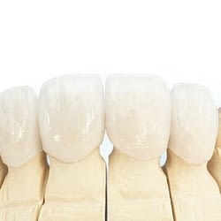 Easy dental crowns - Crown dentist in Kenosha