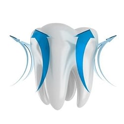 Enamel loss - DIY teeth whitening - Kenosha Dentist