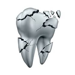 Dental-Emergency-Cracked-Tooth-Kenosha-Dentist